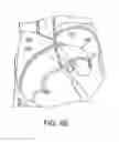 Fig. 08 - Apparatus for safe performance of transseptal technique and placement and positioning of an ablation catheter