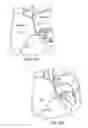 Fig. 09 - Apparatus for safe performance of transseptal technique and placement and positioning of an ablation catheter