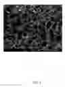 Fig. 02 - DEGRADABLE HEMOSTATIC SPONGE AND  EXTRUSION SYSTEM AND METHOD FOR MANUFACTURING THE SAME