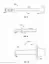 Fig. 06 - Methods and Systems for Interbody Implant and Bone Graft Delivery