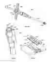 Fig. 10 - Methods and Systems for Interbody Implant and Bone Graft Delivery