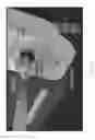 Fig. 92 - Systems and methods for intravenous drug management using immittance spectroscopy