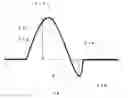 Fig. 01 - Guidewire and ablation catheter system with balloon