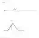 Fig. 02 - Guidewire and ablation catheter system with balloon