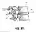 Fig. 12 - Medical instrument and method of use