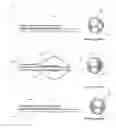 Fig. 06 - Shaft for ablation catheter with balloon