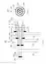 Fig. 04 - Electrosurgical device to generate a plasma stream