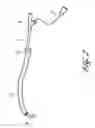 Fig. 03 - SYSTEMS AND METHODS FOR TREATING A HOLLOW ANATOMICAL STRUCTURE