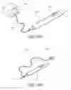 Fig. 41 - SYSTEMS AND METHODS FOR TREATING A HOLLOW ANATOMICAL STRUCTURE
