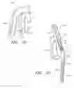 Fig. 12 - SNAP AND TWIST SEGMENTED INTRAMEDULLARY SYSTEM, APPARATUS AND ASSOCIATED METHODS