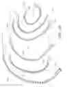 Fig. 35 - SNAP AND TWIST SEGMENTED INTRAMEDULLARY SYSTEM, APPARATUS AND ASSOCIATED METHODS