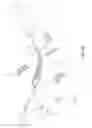 Fig. 03 - Tissue modification devices