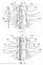 Fig. 06 - METHODS AND DEVICES FOR REPAIRING BONE DEFECTS