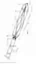 Fig. 04 - Internal bone fixation system with integrated mixer