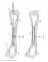Fig. 08 - Internal bone fixation system with integrated mixer