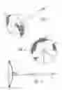Fig. 02 - Method and device for left atrial appendage occlusion