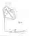 Fig. 06 - Method and device for left atrial appendage occlusion