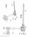 Fig. 03 - Embolus blood clot filter and delivery system