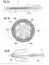 Fig. 10 - Embolus blood clot filter and delivery system