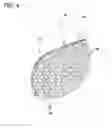 Fig. 09 - Compression sleeve with improved position retention