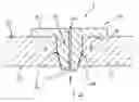 Fig. 01 - DEVICE FOR SEALING AN INCISION