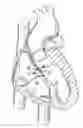 Fig. 01 - SEPTAL DEFECT CLOSURE DEVICE