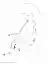 Fig. 01 - Methods and Apparatus for Temporarily Occluding Body Openings
