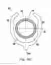 Fig. 35 - Bone plate with captive clips