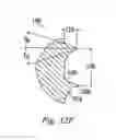 Fig. 46 - Bone plate with captive clips