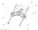 Fig. 01 - Spine stabilization system