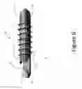 Fig. 07 - PROXIMAL INTERPHALANGEAL FUSION DEVICE