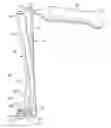 Fig. 01 - Systems and methods for compressing and distracting vertebrae of the spinal column