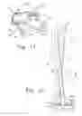 Fig. 07 - Systems and methods for compressing and distracting vertebrae of the spinal column