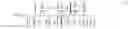 Fig. 02 - Method and system for characterizing supraventricular rhythm during cardiac pacing
