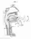 Fig. 04 - Electrical stimulation treatment of hypotension