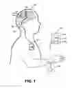 Fig. 02 - Systems and methods for enhancing or optimizing neural stimulation therapy for treating symptoms of parkinsons disease and or other movement disorders