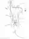 Fig. 02 - Automatic selection of lead configuration for a neural stimulation lead
