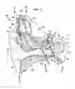 Fig. 02 - Electrode assembly for a stimulating medical device