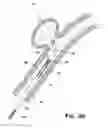 Fig. 04 - System and method for mechanically positioning intravascular implants