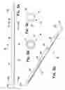 Fig. 08 - System and method for mechanically positioning intravascular implants
