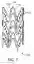 Fig. 02 - Bioabsorbable superficial femoral stent patterns with designed to break links