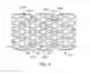 Fig. 07 - Bioabsorbable superficial femoral stent patterns with designed to break links
