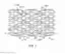Fig. 08 - Bioabsorbable superficial femoral stent patterns with designed to break links