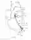 Fig. 22 - Stentless support structure
