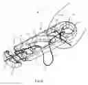 Fig. 07 - Systems and methods for intra-operative tension and fixation of zipknot ACL fixation