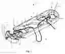 Fig. 08 - Systems and methods for intra-operative tension and fixation of zipknot ACL fixation