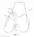 Fig. 22 - Systems and methods for intra-operative tension and fixation of zipknot ACL fixation