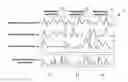 Fig. 01 - Analysis method of vibrational spectra
