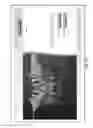 Fig. 06 - Dental implant system and method