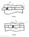 Fig. 08 - Band Clamp With Temporary Band Securing Features